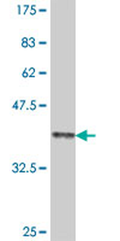 COL11A2 polyclonal antibody (A01)