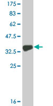 COL9A3 monoclonal antibody (M02A), clone 2B5