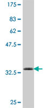 COL9A3 polyclonal antibody (A01)
