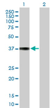 COL9A1 purified MaxPab rabbit polyclonal antibody (D01P)