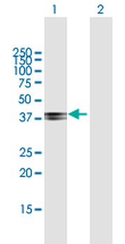 COL9A1 purified MaxPab mouse polyclonal antibody (B01P)