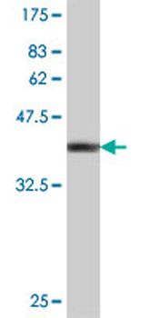 COL9A1 polyclonal antibody (A01)