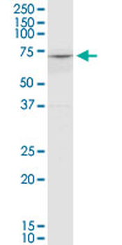 COL8A2 monoclonal antibody (M01), clone 1F4