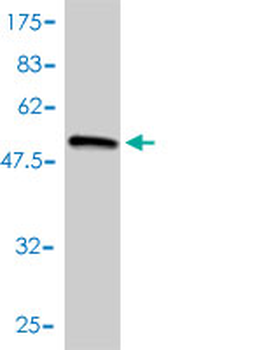 COL2A1 monoclonal antibody (M01), clone 3H1-F9