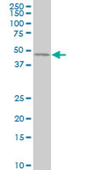 CNTFR polyclonal antibody (A01)
