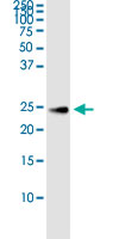 CNTF MaxPab rabbit polyclonal antibody (D01)
