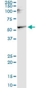 CNR1 monoclonal antibody (M02), clone 1F9