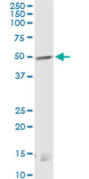 CNR1 monoclonal antibody (M01), clone 2F9