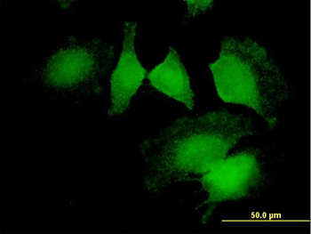 CNN2 MaxPab mouse polyclonal antibody (B01)