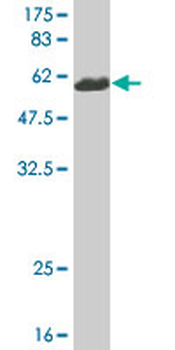 CNN1 monoclonal antibody (M03A), clone 3C7-2A6