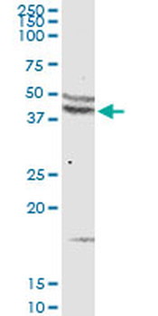 CCR5 purified MaxPab rabbit polyclonal antibody (D01P)