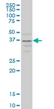 CCR2 monoclonal antibody (M01), clone 4D12