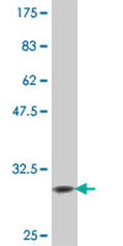 CCR2 polyclonal antibody (A01)