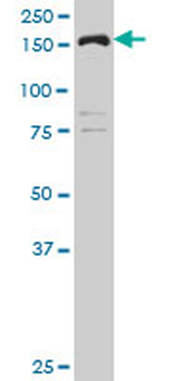 CLTC polyclonal antibody (A01)