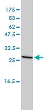 CLTB monoclonal antibody (M01A), clone S1