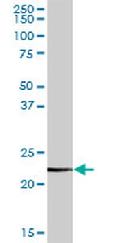 CLTB MaxPab rabbit polyclonal antibody (D01)
