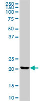 CLTB purified MaxPab mouse polyclonal antibody (B01P)