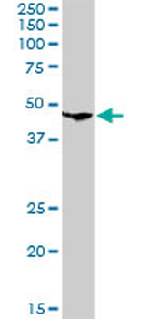 CLN3 purified MaxPab rabbit polyclonal antibody (D01P)