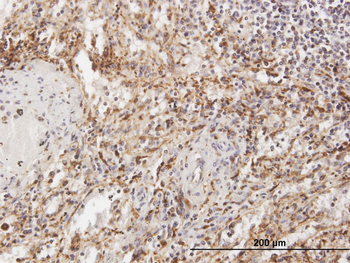 TPP1 purified MaxPab mouse polyclonal antibody (B01P)