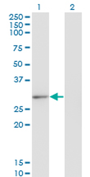 CLIC2 monoclonal antibody (M01), clone 2C1