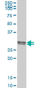 CLIC1 monoclonal antibody (M02), clone 3F9
