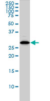 CLIC1 monoclonal antibody (M01), clone 2D4