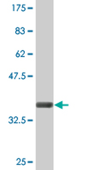 CLCN7 monoclonal antibody (M01A), clone 4A3