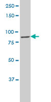 CLCN7 polyclonal antibody (A01)