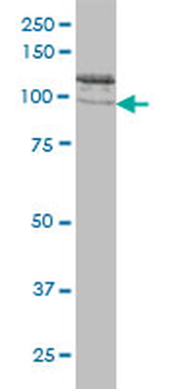 CLCN2 monoclonal antibody (M01), clone 3E1