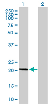 AP3S1 purified MaxPab mouse polyclonal antibody (B02P)