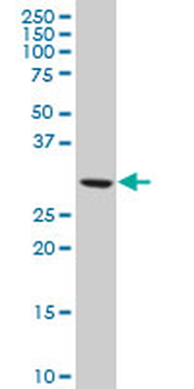 TBCB polyclonal antibody (A01)