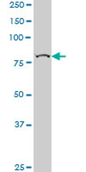 CHUK monoclonal antibody (M04), clone 2G4