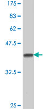 CHRNB4 polyclonal antibody (A01)