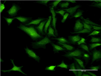 CHRNB3 monoclonal antibody (M01), clone 3G6