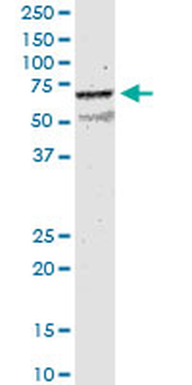 CHRNB2 monoclonal antibody (M01), clone 1C7