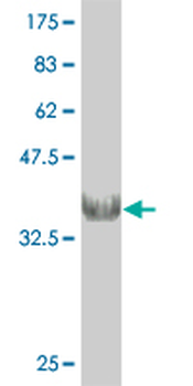 CHRNB1 monoclonal antibody (M01), clone 4G4