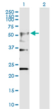 CHRNA4 purified MaxPab rabbit polyclonal antibody (D01P)