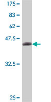 CHRNA2 polyclonal antibody (A01)