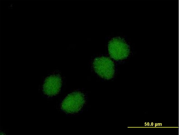 CHKB purified MaxPab mouse polyclonal antibody (B01P)