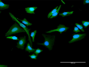 CHKA purified MaxPab rabbit polyclonal antibody (D01P)