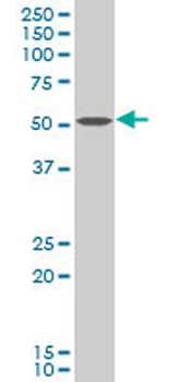 CHKA polyclonal antibody (A01)