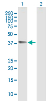 CHI3L1 purified MaxPab mouse polyclonal antibody (B01P)