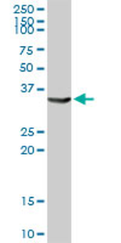AKR1C4 MaxPab rabbit polyclonal antibody (D01)