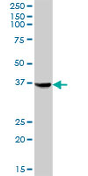 AKR1C4 purified MaxPab mouse polyclonal antibody (B01P)