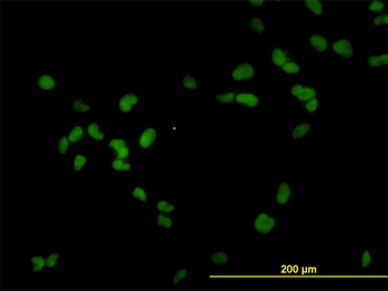 RCC1 monoclonal antibody (M01), clone 2F1