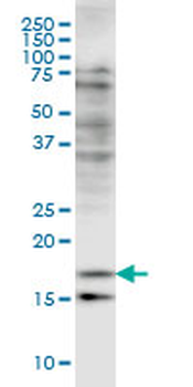CFL2 monoclonal antibody (M03), clone 6G9