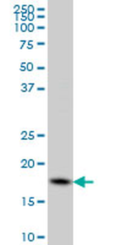 CFL1 monoclonal antibody (M04), clone 1A1