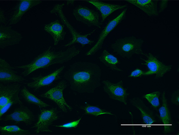 CETN3 purified MaxPab mouse polyclonal antibody (B01P)