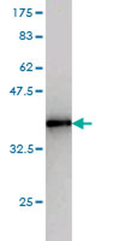 CETN2 monoclonal antibody (M01), clone 3F8
