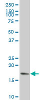CETN2 polyclonal antibody (A02)